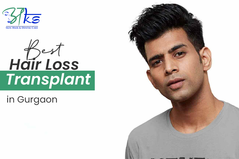 Best Hair Loss Treatment in Gurgaon, Delhi NCR