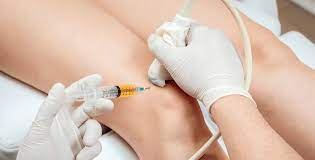 Can you walk after PRP injection