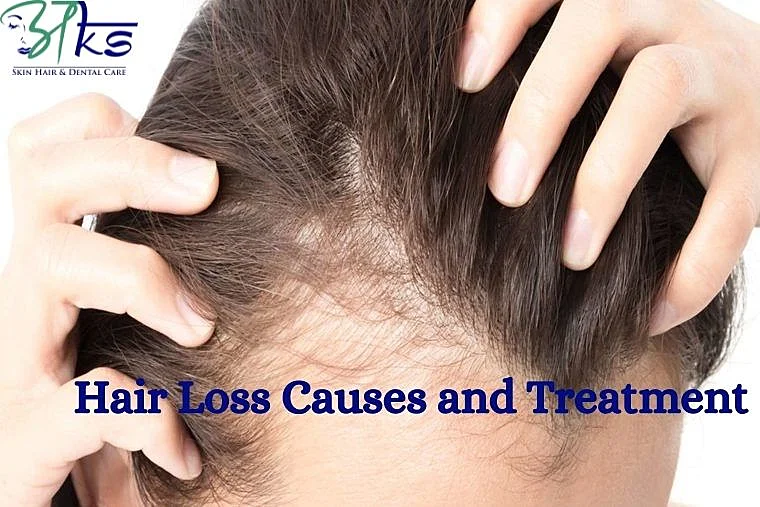 Hair Loss: Common Causes and Treatment