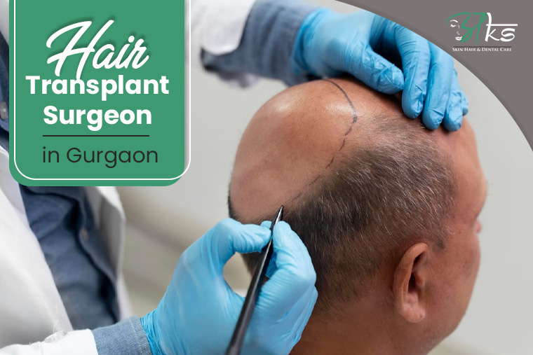 Hair Transplant Surgeon in Gurgaon