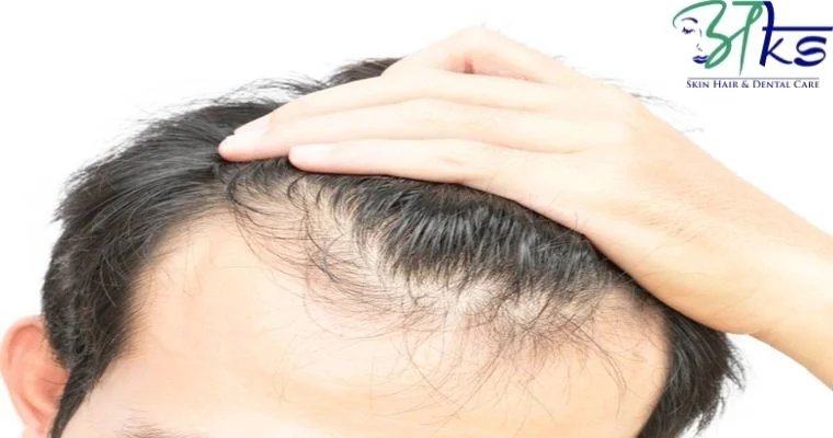Is it possible to regrow hair without a hair transplant