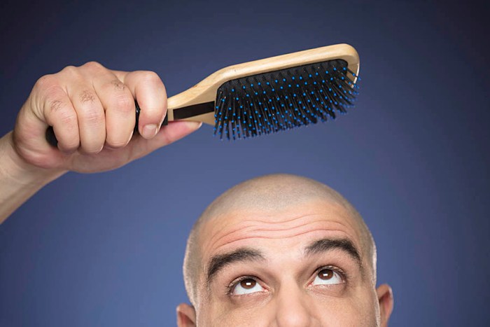 What is the success rate of hair transplant