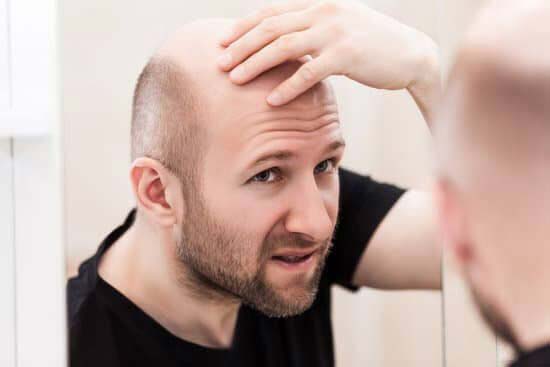 Can a man's hair grow back