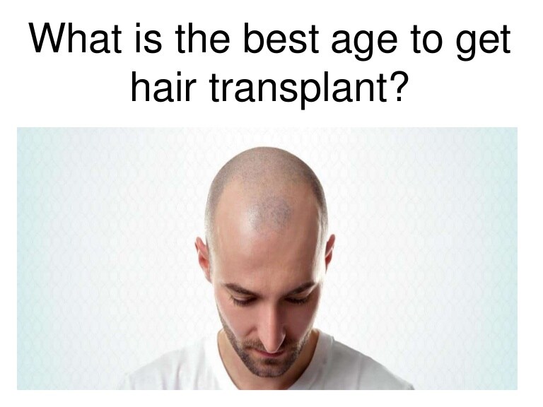 What is the best age for hair transplant