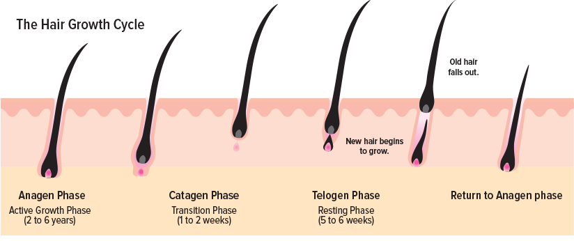 Do Hair Transplants really work