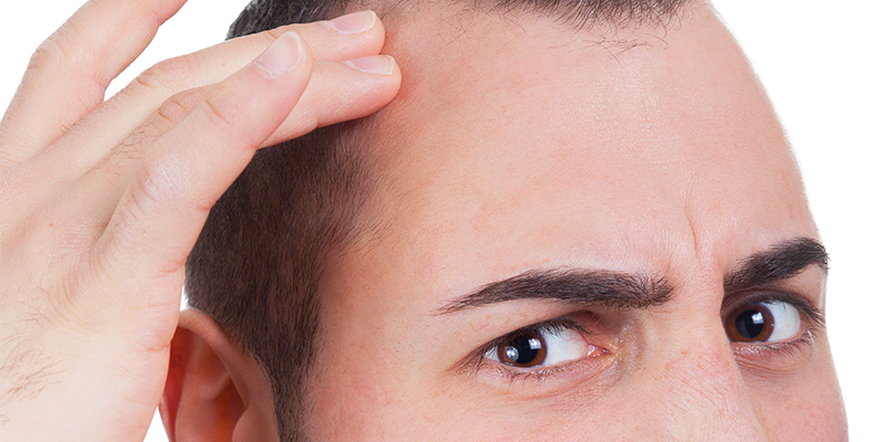 What is the best treatment for male hair loss