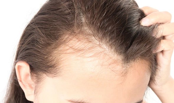 Does vitamin D help regrow hair