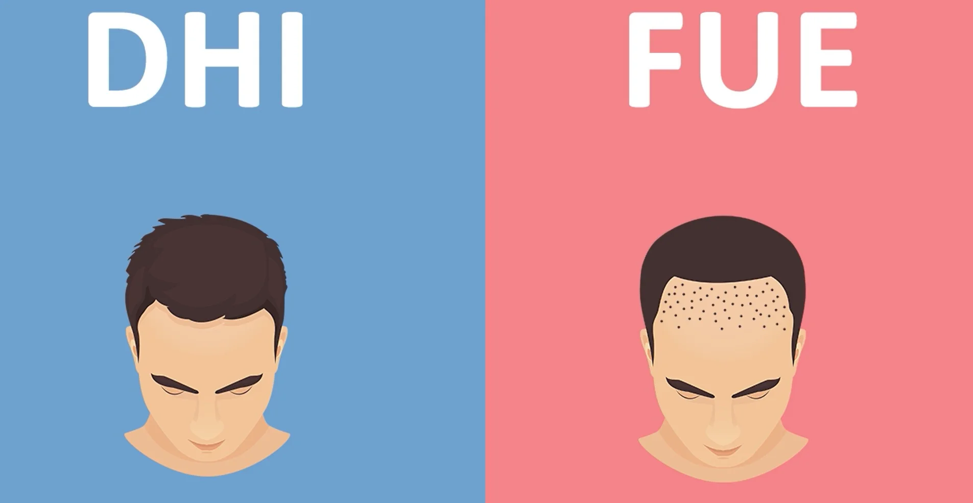 What's the difference between FUE and DHI
