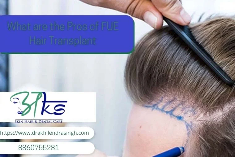 What are the pros of the FUE Hair Transplant
