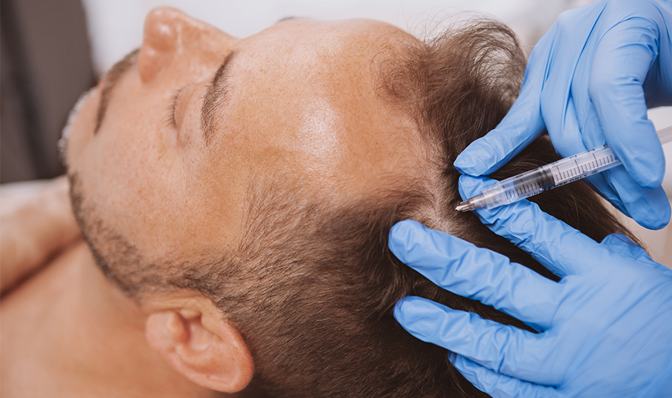 What are the side effects of PRP treatment