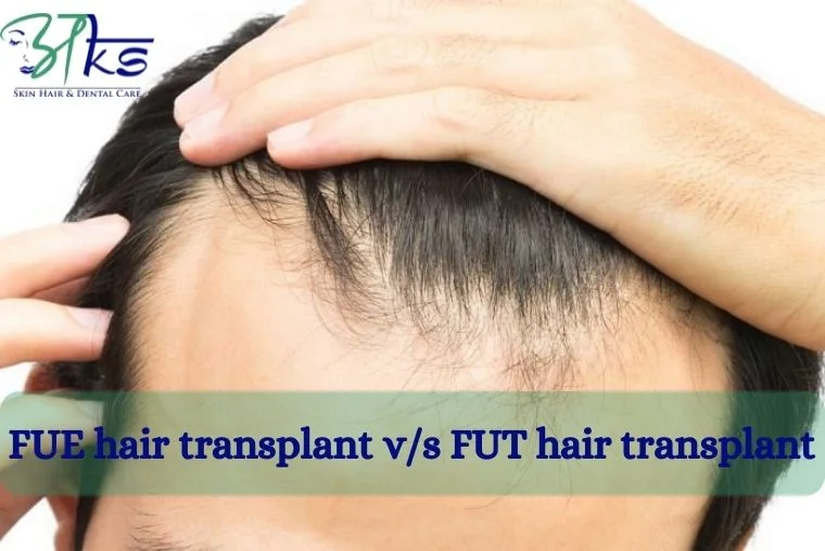 What is difference between FUE hair transplant and FUT hair transplant