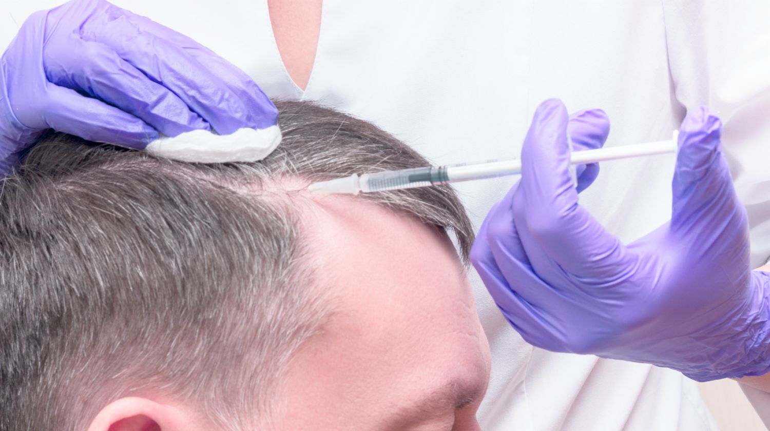 What is PRP treatment good for