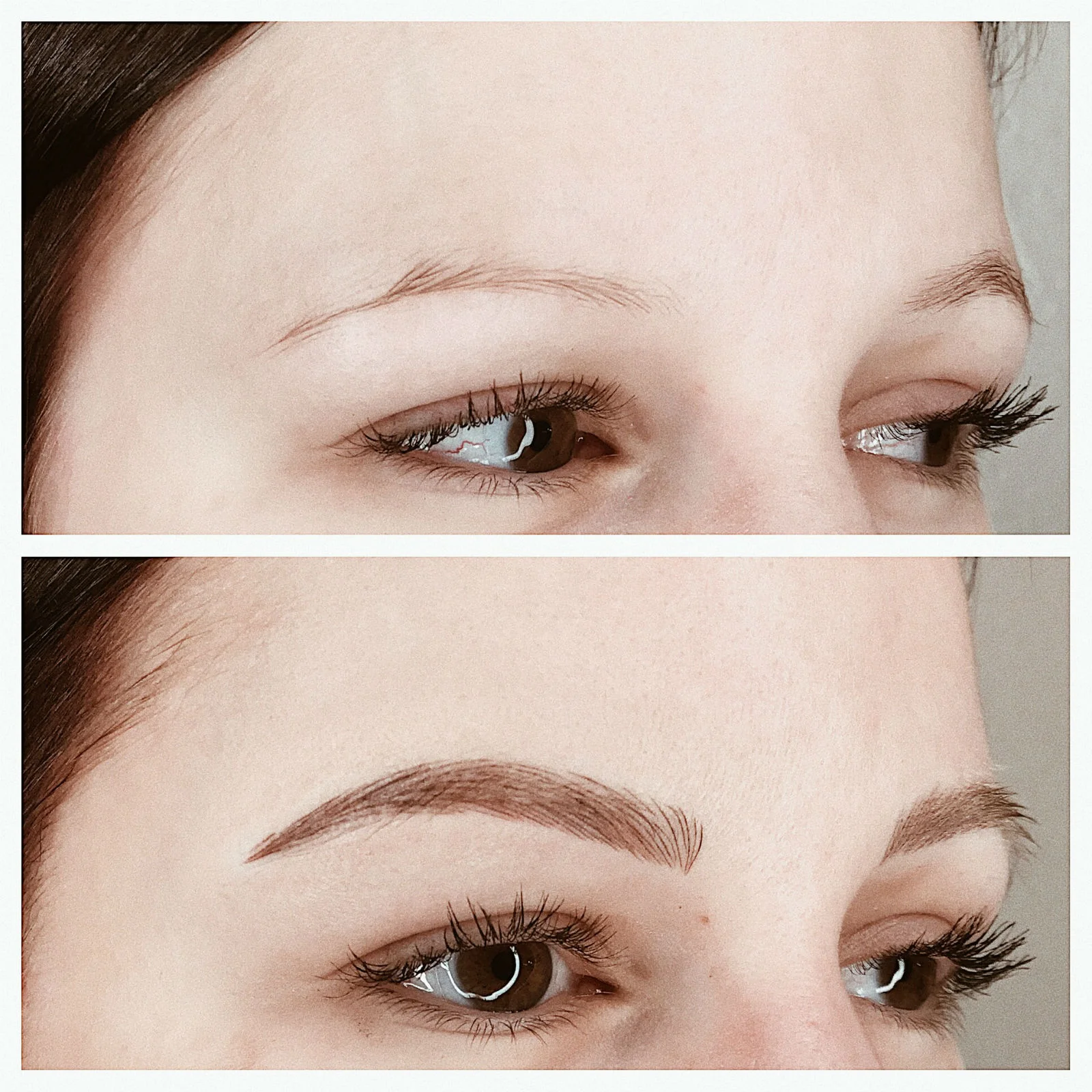What is the most natural Eyebrow Procedure