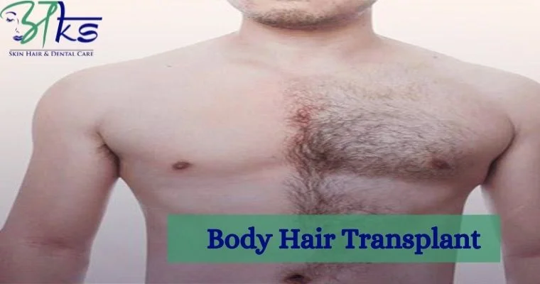 What is the success rate of body hair transplant