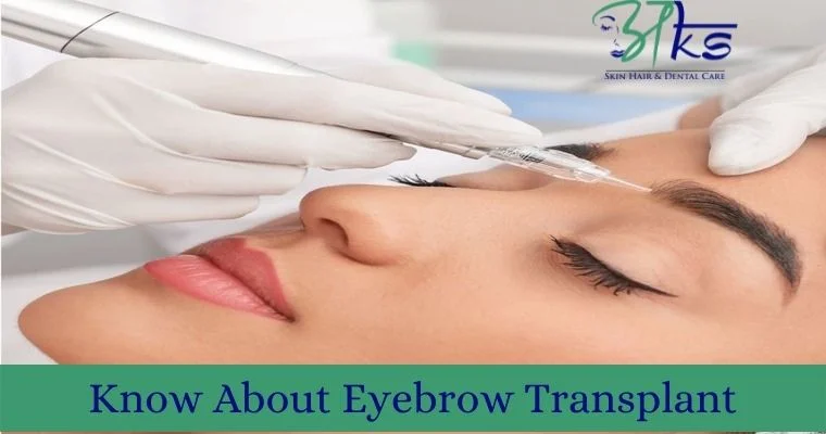 What to know about Eyebrow transplant