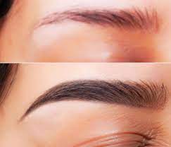Will minoxidil regrow Eyebrows