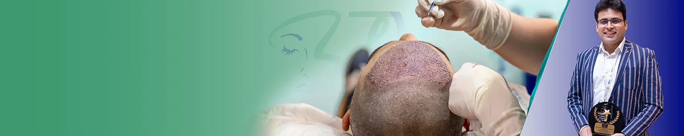Best Direct Hair Transplantation Doctor in Gurgaon Delhi NCR