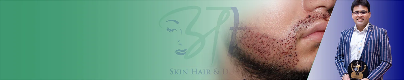 Best Mustaches and Beard Hair Transplant in Gurgaon Delhi NCR